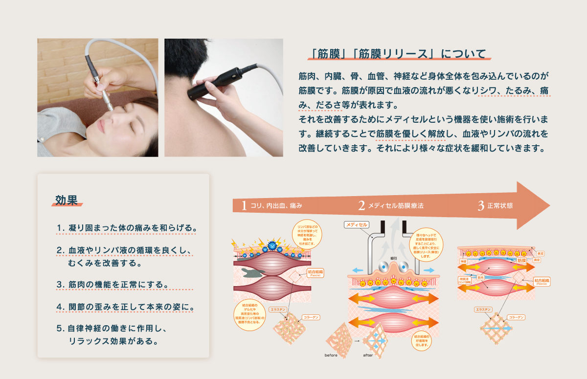 筋膜リリースとは